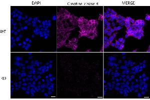 Immunocytochemical staining of HeLa cells using Creatine kinase B antibody (ABIN7798163), 1:1,000), Top panel: wild-type (WT), Bottom panal: Creatine kinase B shRNA knockdown (KD).