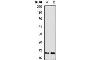 Western blot analysis of GADD45 alpha expression in mouse liver (A), mouse kidney (B) whole cell lysates. (GADD45A antibody)