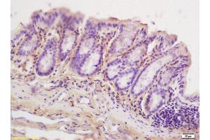 Formalin-fixed and paraffin embedded mouse small intestine tissue labeled with Anti-ERG25 Polyclonal Antibody, Unconjugated  at 1:200 followed by conjugation to the secondary antibody and DAB staining (SC4MOL antibody  (AA 131-230))