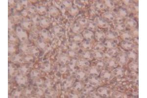 Immunohistochemistry (IHC) image for anti-alpha-2-Macroglobulin (A2M) (AA 1053-1214) antibody (ABIN1857846)