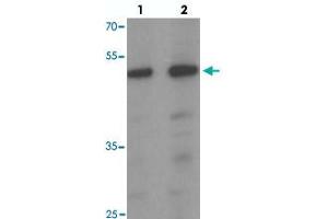 Western blot analysis of SAMSN1 in HeLa cell lysate with SAMSN1 polyclonal antibody  at (1) 0. (SAMSN1 antibody  (C-Term))