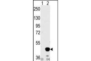 Western Blotting (WB) image for anti-Mitogen-Activated Protein Kinase Kinase 2 (MAP2K2) (AA 262-292) antibody (ABIN392485)