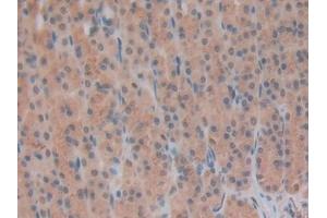 Detection of INHbB in Rat Stomach Tissue using Polyclonal Antibody to Inhibin Beta B (INHbB)