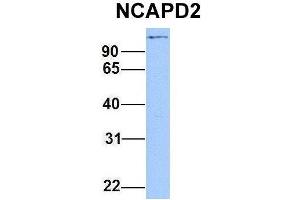 Host:  Rabbit  Target Name:  NCAPD2  Sample Type:  Hela  Antibody Dilution:  1. (NCAPD2 antibody  (C-Term))