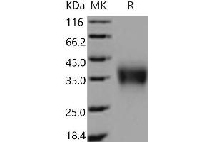 Western Blotting (WB) image for Fc Fragment of IgG, Low Affinity IIb, Receptor (CD32) (FCGR2B) (Active) protein (His tag) (ABIN7195694) (FCGR2B Protein (His tag))