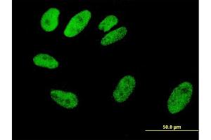 Immunofluorescence of monoclonal antibody to SRF on HeLa cell. (SRF antibody  (AA 406-508))