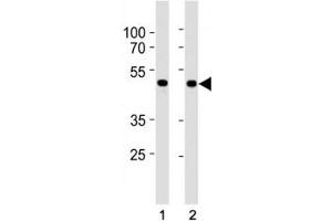 Western Blotting (WB) image for anti-SMAD, Mothers Against DPP Homolog 3 (SMAD3) (AA 186-215) antibody (ABIN3032621)