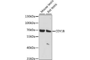 Western blot analysis of extracts of various cell lines, using CDY1B antibody (ABIN7266365) at 1:1000 dilution. (CDY1B antibody  (AA 60-320))