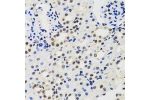 Immunohistochemistry of paraffin-embedded mouse kidney using CIRBP antibody. (CIRBP antibody  (AA 1-172))