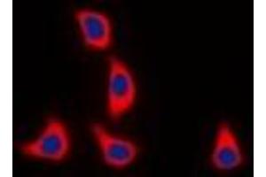 Immunofluorescent analysis of WASF1 (pY125) staining in K562 cells. (WASF1 antibody  (pTyr125))