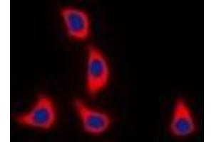 Immunofluorescent analysis of WASF1 (pY125) staining in K562 cells.