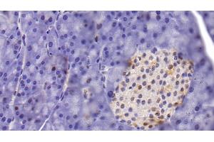 Immunohistochemistry (IHC) image for anti-Histone Deacetylase 1 (HDAC1) (AA 1-482) antibody (ABIN7426493)