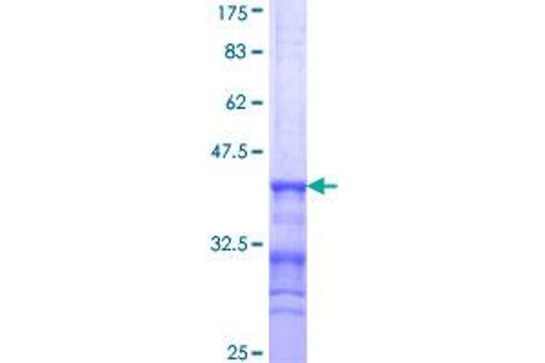 BAT3 Protein (AA 1033-1132) (GST tag)
