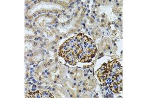 Immunohistochemistry (Paraffin-embedded Sections) (IHC (p)) image for anti-Cholesteryl Ester Transfer Protein (CETP) (AA 300-493) antibody (ABIN3021919)