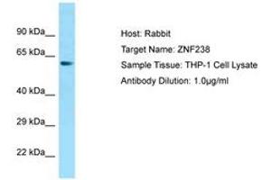 Image no. 1 for anti-Zinc Finger Protein 238 (ZNF238) (AA 143-192) antibody (ABIN6749839)