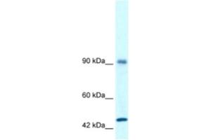 Western Blotting (WB) image for anti-RNA Binding Motif Protein 10 (RBM10) antibody (ABIN2460169) (RBM10 antibody)