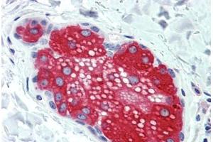 Anti-SUSD2 antibody  ABIN960825 IHC staining of human skin, sebaceous gland. (SUSD2 antibody  (Internal Region))