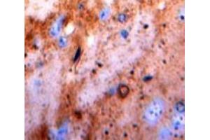 IHC-P analysis of Brain tissue, with DAB staining. (Pkc beta 1 antibody  (AA 342-600))