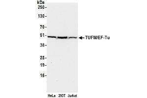 Western Blotting (WB) image for anti-Tu Translation Elongation Factor, Mitochondrial (Tufm) (AA 402-452) antibody (ABIN7453234)