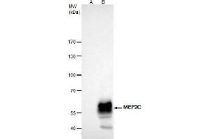 Immunoprecipitation (IP) image for anti-Myocyte Enhancer Factor 2C (MEF2C) antibody (ABIN2856105)