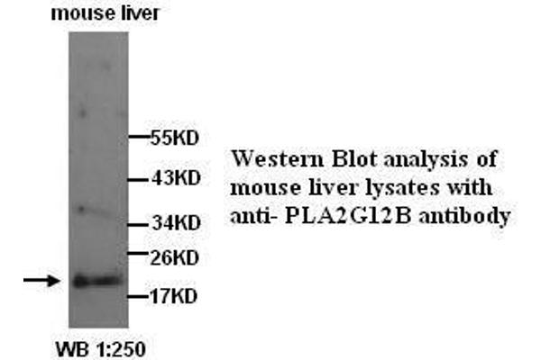 PLA2G12B antibody  (N-Term)