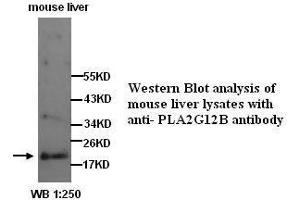 PLA2G12B 抗体  (N-Term)