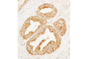 Immunohistochemistry (IHC) image for anti-MARCKS-Like 1 (MARCKSL1) (AA 145-195) antibody (ABIN7453523)
