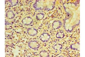 Immunohistochemistry of paraffin-embedded human small intestine tissue using ABIN7159237 at dilution of 1:100 (PRAME antibody  (AA 1-509))