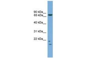 Image no. 1 for anti-MRE11 Meiotic Recombination 11 Homolog A (S. Cerevisiae) (MRE11A) (AA 35-84) antibody (ABIN6745121) (Mre11 antibody  (AA 35-84))