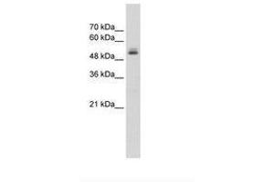 Image no. 1 for anti-Pre-mRNA Processing Factor 19 (PRPF19) (N-Term) antibody (ABIN203526)