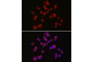 Immunofluorescence analysis of Neuro-2a cells using DCX Rabbit pAb (ABIN7266839) at dilution of 1:150 (40x lens). (Doublecortin antibody  (AA 240-360))