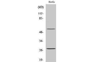 Western Blotting (WB) image for anti-CD69 (CD69) (Internal Region) antibody (ABIN3174275) (CD69 antibody  (Internal Region))