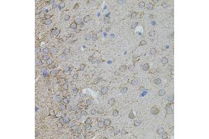Immunohistochemistry of paraffin-embedded mouse brain using MMP10 antibody (ABIN5971553) at dilution of 1/100 (40x lens). (MMP10 antibody)