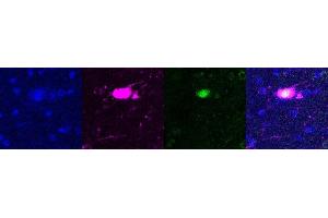 Immunohistochemistry (IHC) image for anti-SATB Homeobox 2 (SATB2) antibody (ABIN7456088) (SATB2 antibody)