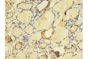 Immunohistochemistry of paraffin-embedded human thyroid tissue using ABIN7172152 at dilution of 1:100 (THRB antibody  (AA 1-461))
