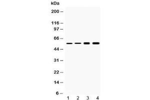 Western blot testing of 1) rat liver, 2) mouse liver, 3) human HeLa and 4) human HepG2 lysate with Cytokeratin 18 antibody at 0. (Cytokeratin 18 antibody)