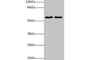 Western blot All lanes: ESR2 antibody at 2 μg/mL Lane 1: Mouse brain tissue Lane 2: PC-3 whole cell lysate Secondary Goat polyclonal to rabbit IgG at 1/10000 dilution Predicted band size: 60, 56, 36, 58, 55, 53, 49, 42, 54 kDa Observed band size: 60 kDa (ESR2 antibody  (AA 2-530))