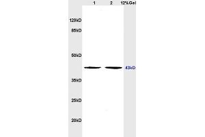 L1 rat brain, L2 rat heart lysates probed (ABIN677828) at 1:200 in 4 °C. (Serotonin Receptor 4 antibody  (AA 21-120))
