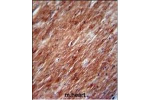 IL2 Antibody (Center) (ABIN390899 and ABIN2841106) immunohistochemistry analysis in formalin fixed and paraffin embedded mouse heart tissue followed by peroxidase conjugation of the secondary antibody and DAB staining.
