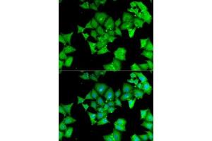Immunofluorescence analysis of MCF7 cells using  antibody (ABIN6127428, ABIN6136509, ABIN6136511 and ABIN6217463). (Aminoacylase 1 antibody  (AA 1-408))