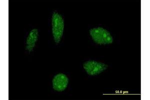 Immunofluorescence of monoclonal antibody to KHSRP on HeLa cell.