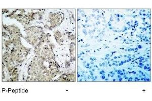 Image no. 1 for anti-Mitogen-Activated Protein Kinase Kinase 6 (MAP2K6) (pSer207) antibody (ABIN196865) (MAP2K6 antibody  (pSer207))