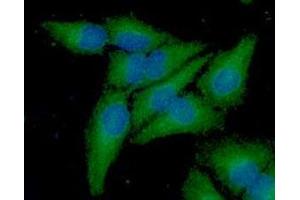 ICC/IF analysis of Frataxin in A549 cell line, stained with DAPI (Blue) for nucleus staining and monoclonal anti-human Frataxin antibody (1:100) with goat anti-mouse IgG-Alexa fluor 488 conjugate (Green). (Frataxin antibody  (AA 42-210))