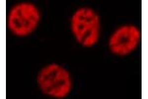 ABIN6274369 staining Hela cells by IF/ICC. (Translin antibody  (Internal Region))