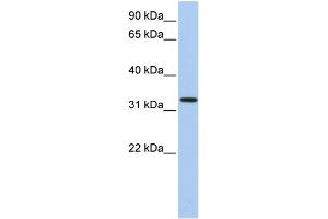 WB Suggested Anti-C12orf24 Antibody Titration: 0. (C12ORF24 antibody  (N-Term))