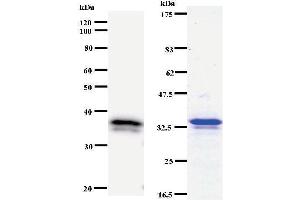 Left: DHX38 staining. (DHX38 antibody)