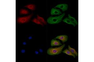 ABIN7094481 and ABIN7098530 staining Hela cells by IF/ICC.