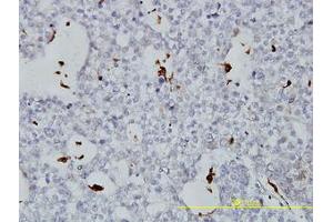 Image no. 3 for anti-Phospholipid Transfer Protein (PLTP) (AA 1-422) antibody (ABIN466078) (PLTP antibody  (AA 1-422))