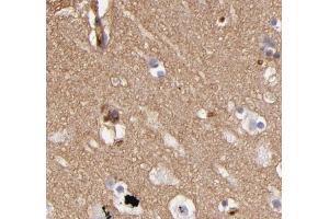 ABIN6268733 for IHC in human brain tissue (ABCB1 antibody  (Internal Region))