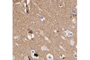 ABIN6268733 for IHC in human brain tissue (ABCB1 antibody  (Internal Region))